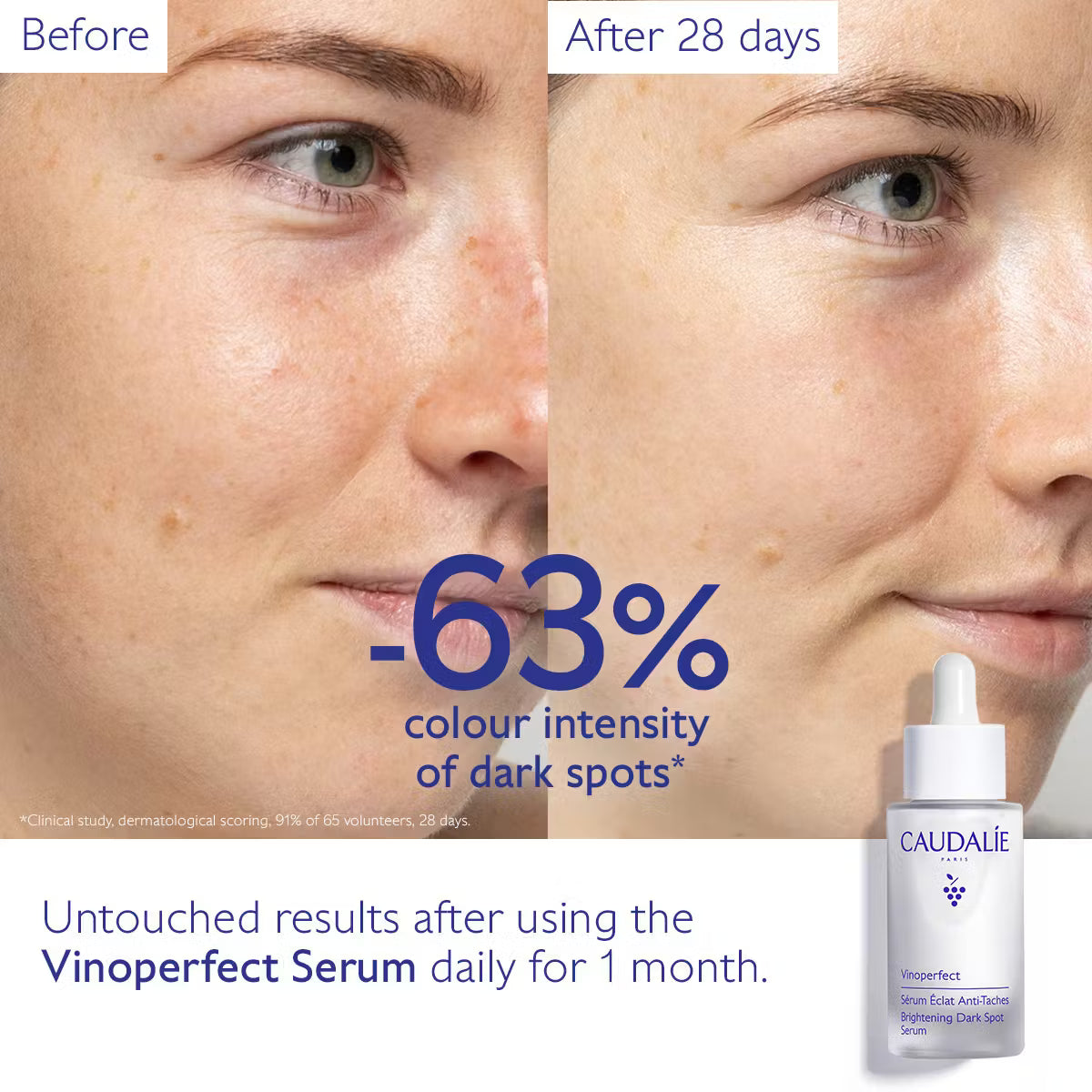 Vinoperfect Dark Spot Brightening Serum Vitamin C Alternative - 30ml