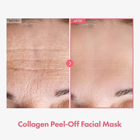 REAL COLLAGEN FTT