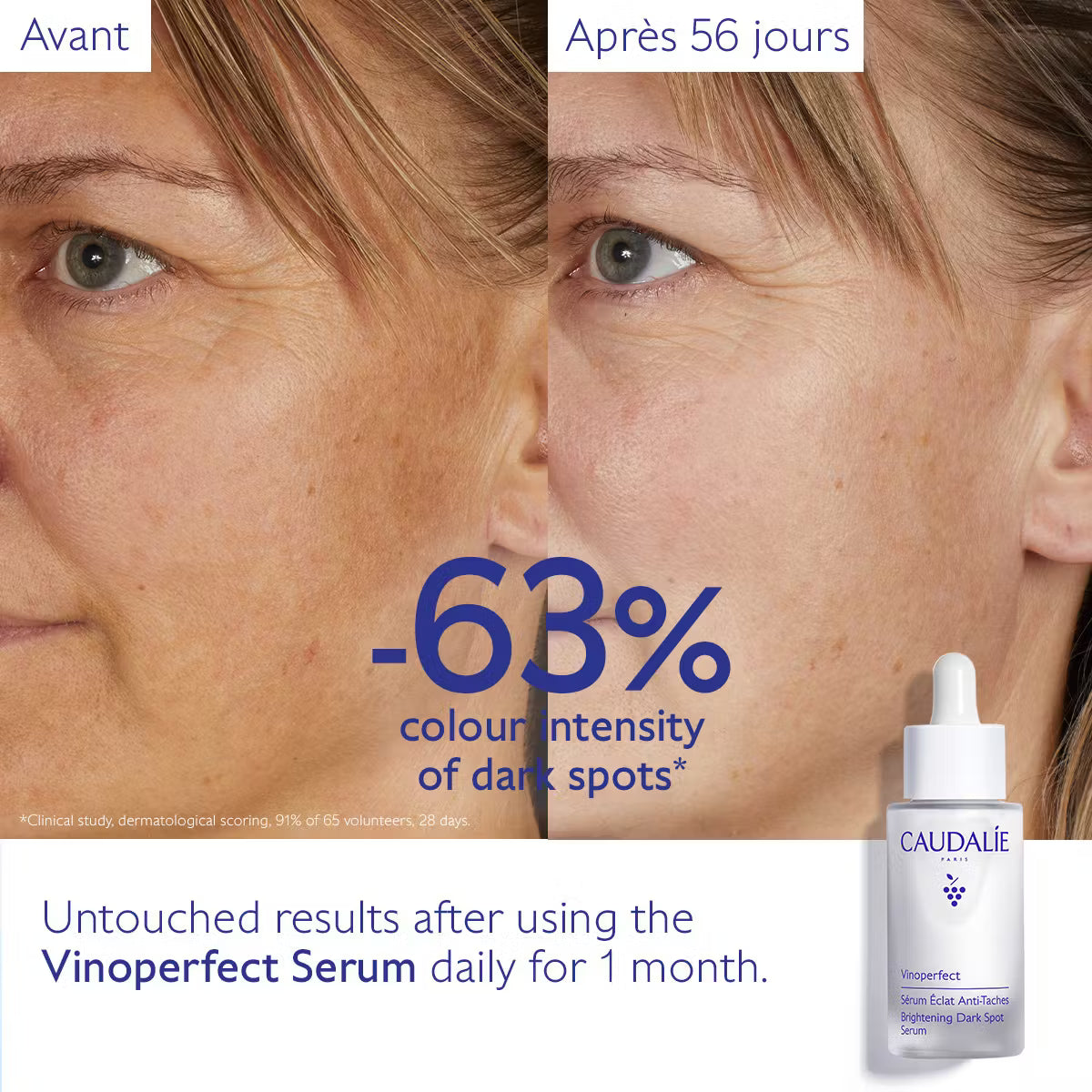 Vinoperfect Dark Spot Brightening Serum Vitamin C Alternative - 30ml
