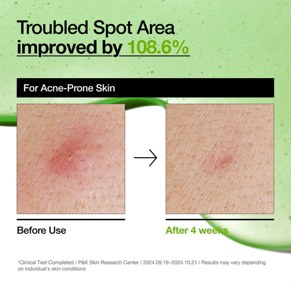 Anua 10+ Azelaic Acid Hyaluron Soothing Serum